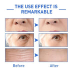 Botox Anti-Aging Serum, Youthfully Botox Face Serum(Pack Of 1)